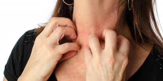Skin care tips for atopic dermatitis and eczema
