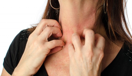 Skin care tips for atopic dermatitis and eczema